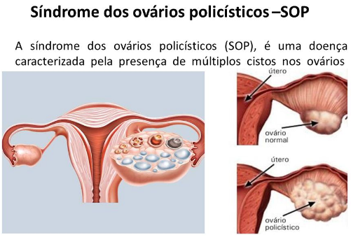 Ovário