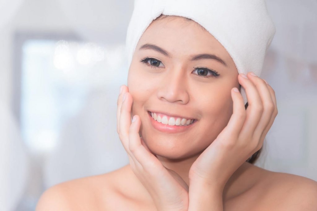 melasma